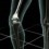Crean huesos artificiales a partir de células madres