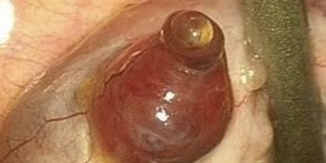 Nunca lo había visto como era… la asombrosa ovulación humana en fotos únicas de la historia